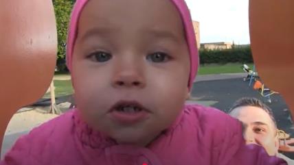 Prohodala devojčica rođena sa nogama okrenutim unazad