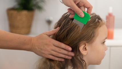 Saveti doktora kako se rešiti vaški