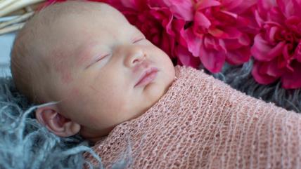 Zašto se pojavljuje beleg na bebinoj koži