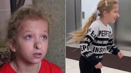 Varja, devojčica sa neobičnim nosom