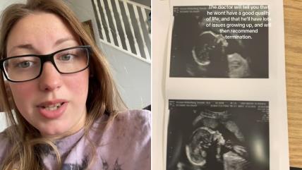 Mama Danijela i ultrazvuk bebe