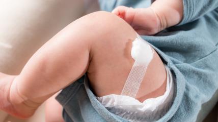 Bebi zalepljen flaster na nogu