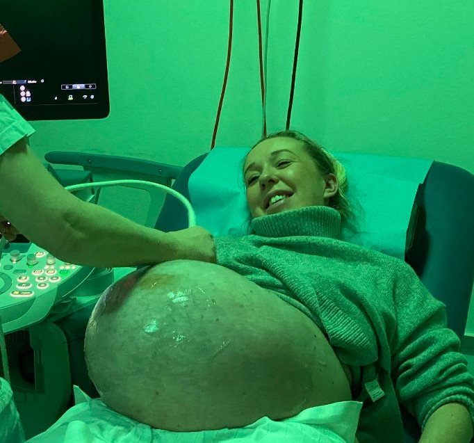 trudnica s trojkama3.png