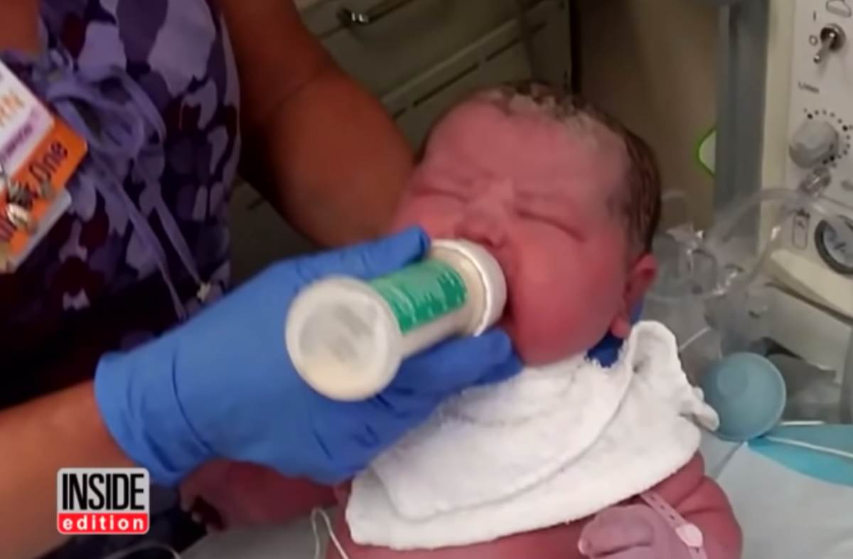 Beba rođena sa 6 i po kilograma