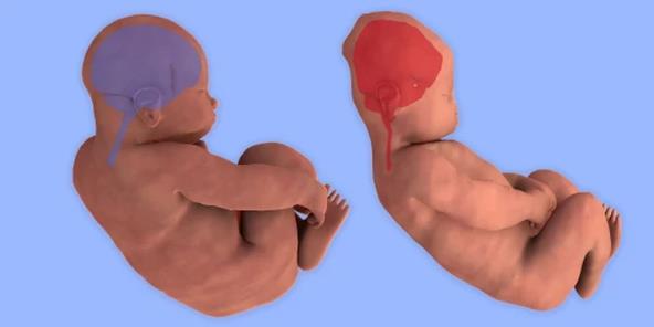 Šta se dešava sa glavom bebe tokom porođaja.jpg