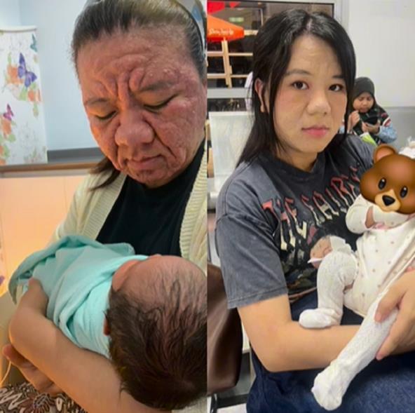 Ženi u trudnoći imala lice starice