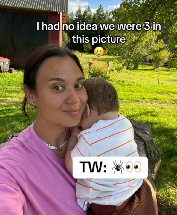 Bebi se krpelj zakačio na trepavice