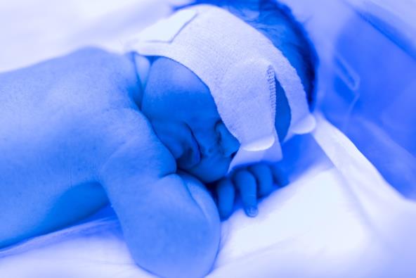 Kada je žutica kod beba opasna