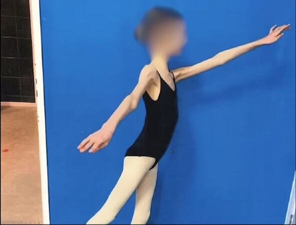 Devojčica zbog maltretiranja roditelija bila neuhranjena