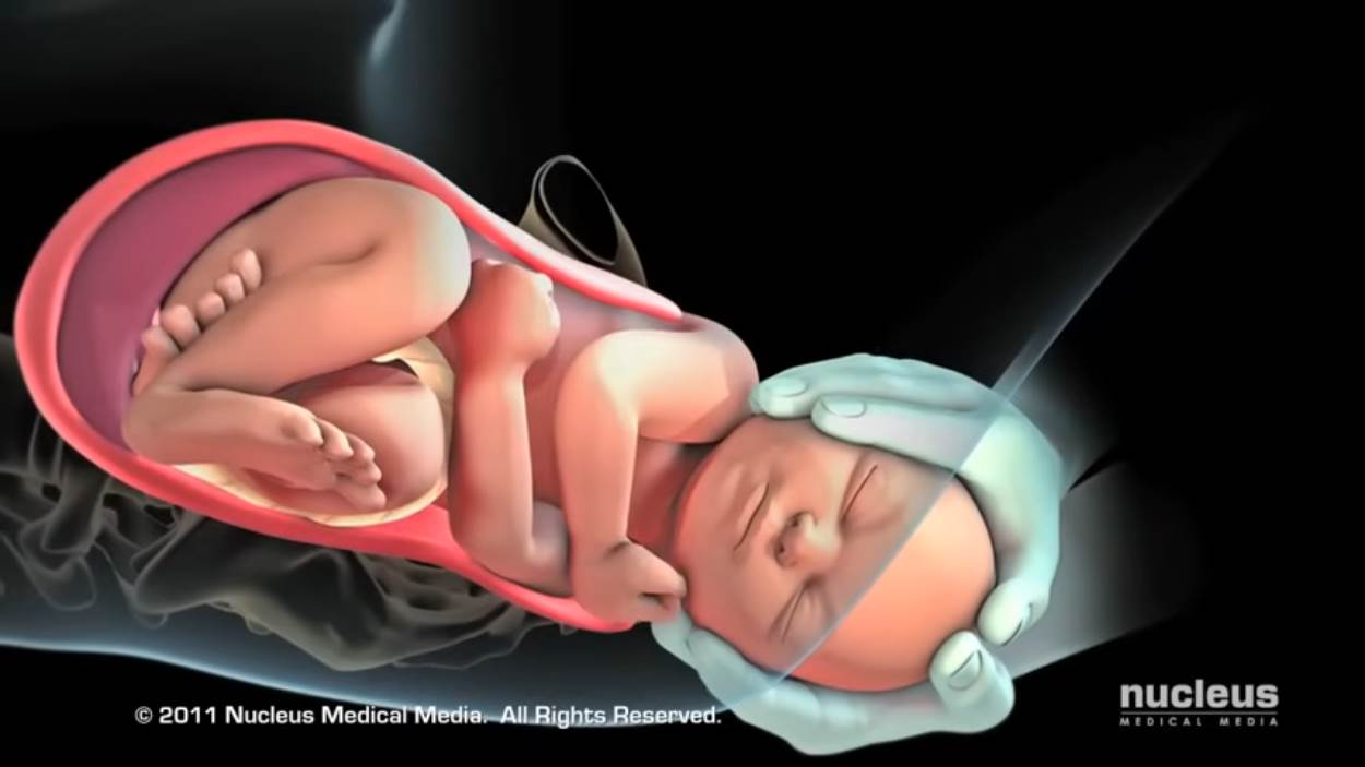 Nucleus Medical Media - Patient Education Animation Labor and Vaginal Birth [ZDP_ewMDxCo - 1250x703 - 2m16s].jpg