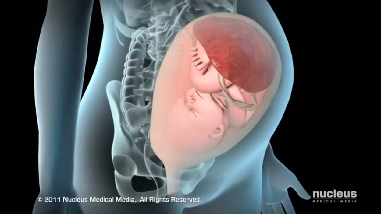 Nucleus Medical Media - Patient Education Animation Labor and Vaginal Birth [ZDP_ewMDxCo - 1250x703 - 0m06s].png