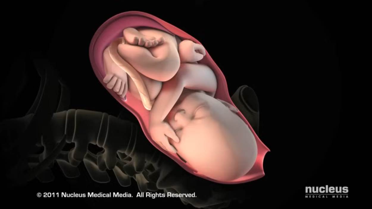 Nucleus Medical Media - Patient Education Animation Labor and Vaginal Birth [ZDP_ewMDxCo - 1250x703 - 1m06s].png