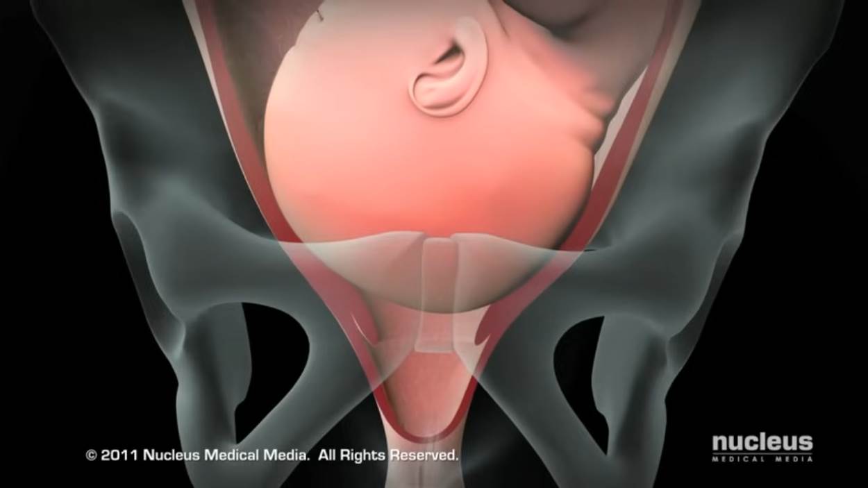 Nucleus Medical Media - Patient Education Animation Labor and Vaginal Birth [ZDP_ewMDxCo - 1250x703 - 1m00s].png