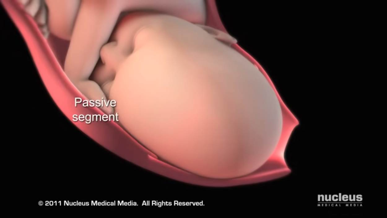 Nucleus Medical Media - Patient Education Animation Labor and Vaginal Birth [ZDP_ewMDxCo - 1250x703 - 1m27s].png