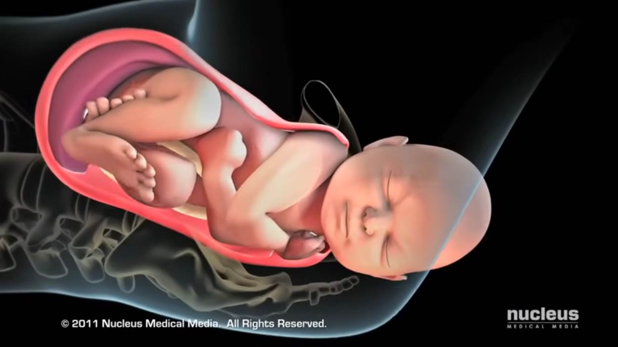 Nucleus Medical Media - Patient Education Animation Labor and Vaginal Birth [ZDP_ewMDxCo - 1250x703 - 2m11s].png