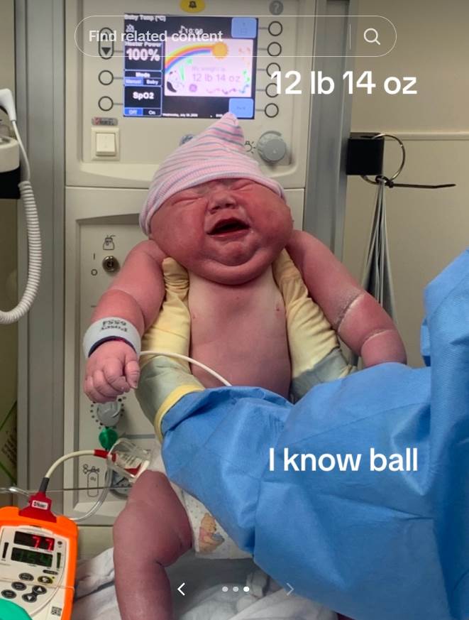 Žena rodila krupnu bebu