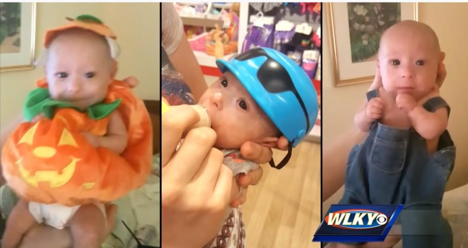 Beba patuljastog rasta