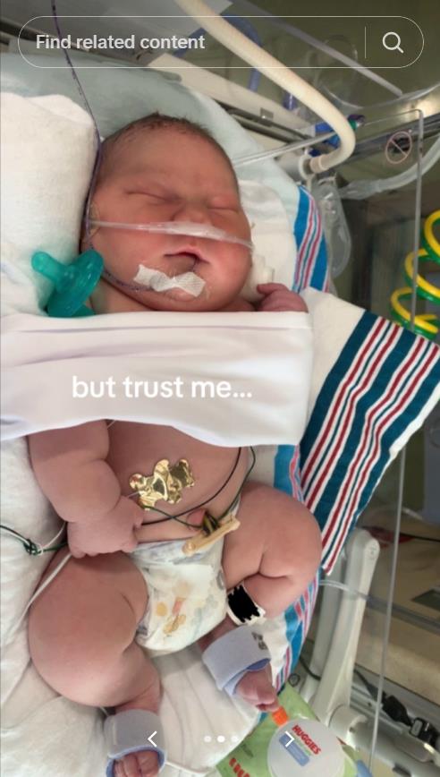 Žena rodila krupnu bebu